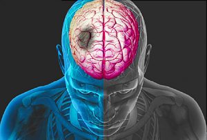CoronaVírus (Covid19), Neurociência e Sistema Imune